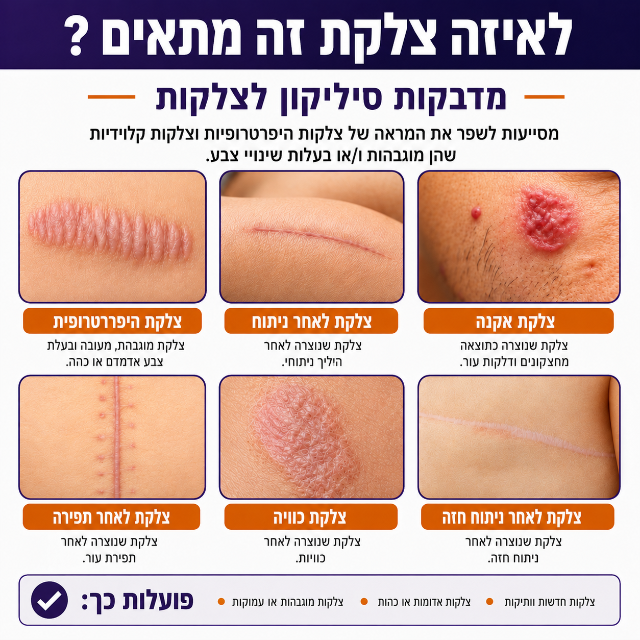 ארפפלסטר – סיליקון רפואי פרימיום | גליל 3 מ'